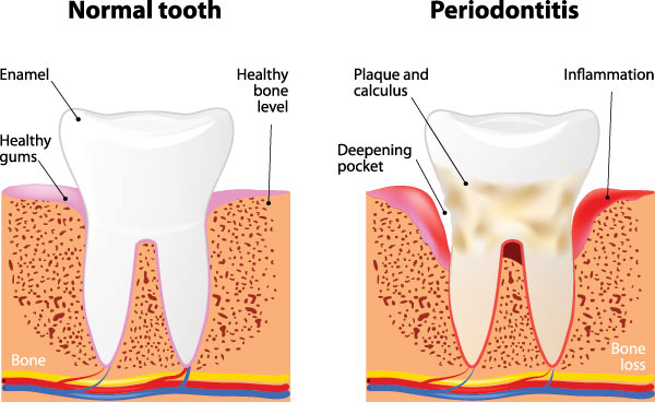 Dean Dental | Emergency Treatment, Dentures and Sports Mouthguards