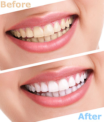 Dean Dental | Periodontal Treatment, Botox reg  and Juvederm reg 