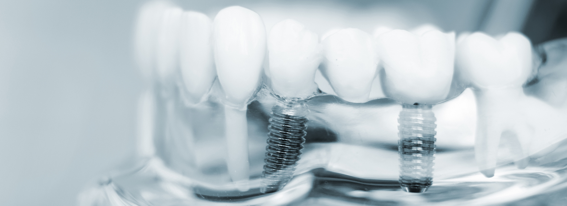 Dean Dental | Sleep Apnea, Sports Mouthguards and Dentures